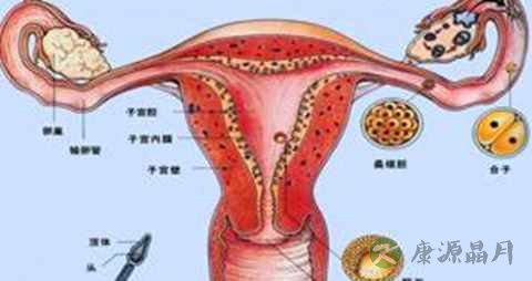 纵隔子宫要开刀吗