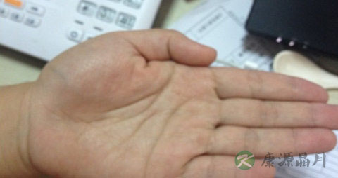 生命线短代表什么，不会长寿吗