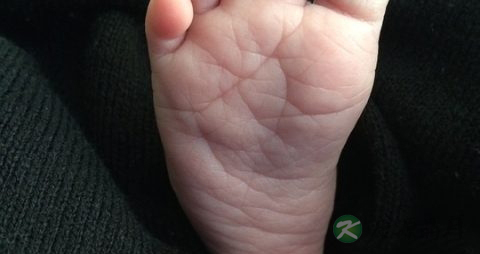 脚趾头痛怎么办