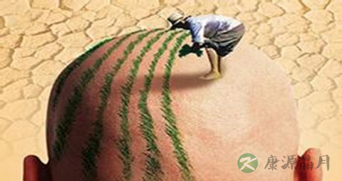 有什么可以治疗脱发