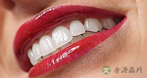 怎样才能让牙齿美白