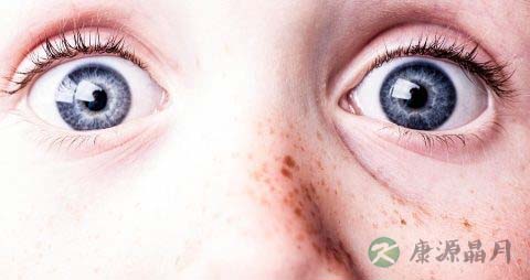 结膜充血的原因