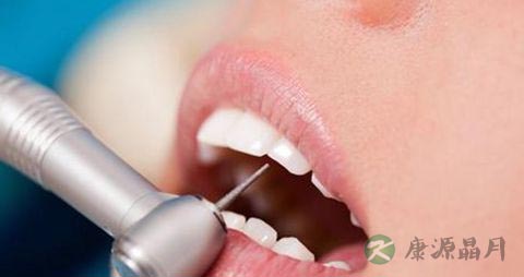 镍铬烤瓷牙多少钱