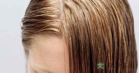 油性发质会脱发吗