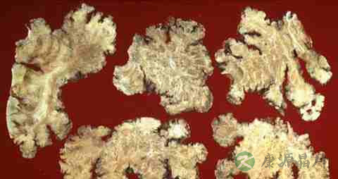 治疗脱发用什么药好