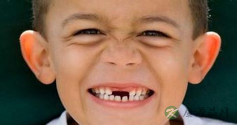 儿童牙齿痛吃什么药