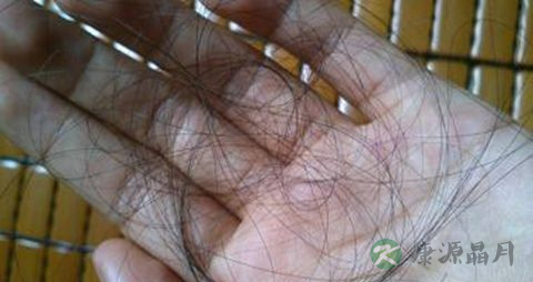 肾虚脱发能恢复吗