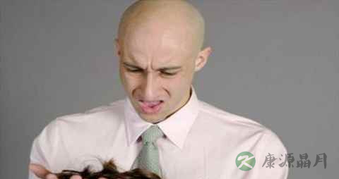 遗传性脱发能治吗