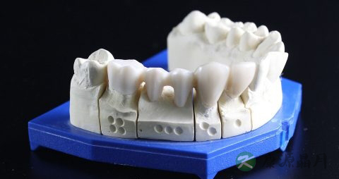暴牙矫正的方法