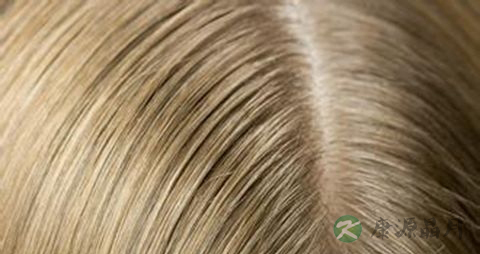 吃什么头发长得快