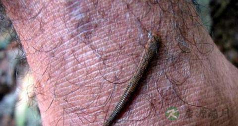 吸血虫的感染方式