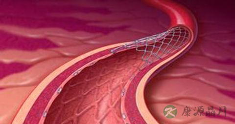 血栓病人适合吃什么