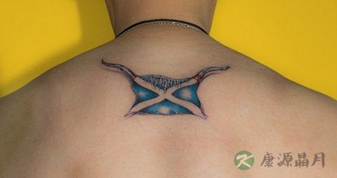 颈部僵硬怎么办