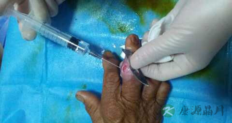 风湿吃什么食物