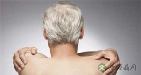 脱发白发的原因