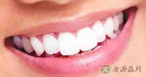 吃什么水果可以美白牙齿