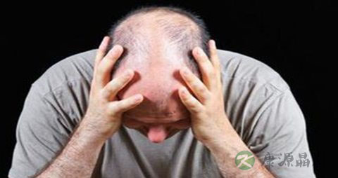 防脱发的最好方法