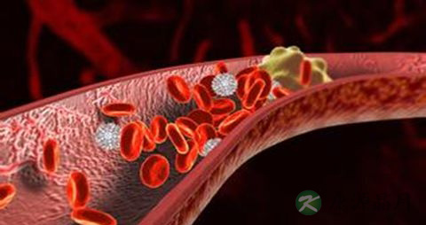 治疗血栓吃什么药