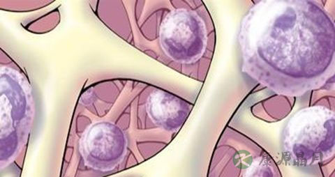 骨髓纤维化的饮食