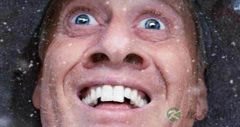 牙套多少钱一个