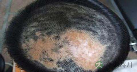 防止脱发吃什么