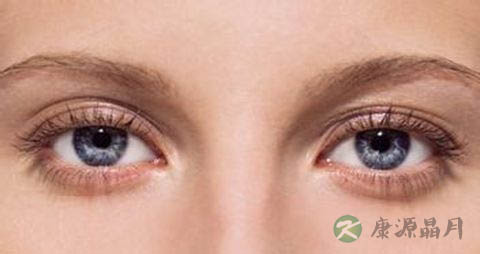 吃那些东西对眼睛好