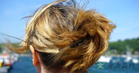 斑秃用什么药好