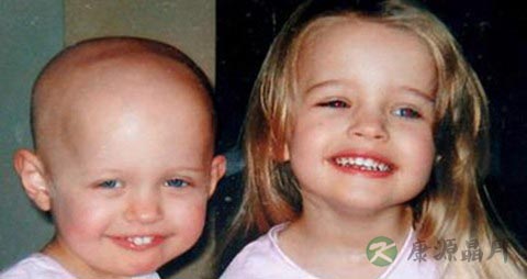 骨髓增生异常综合症饮食