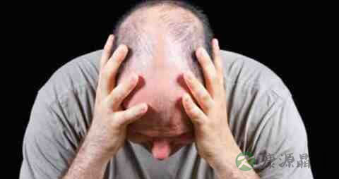 失眠脱发吃什么药