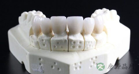 全口义齿多少钱