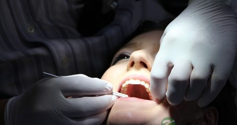 全瓷牙要多少钱