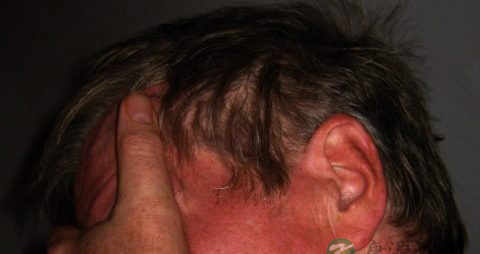 吃什么治疗腹泻