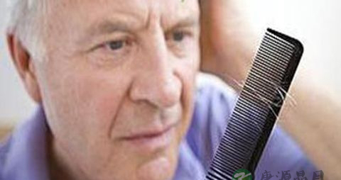 有什么可以防止脱发