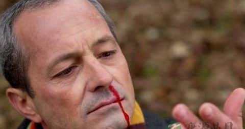 鼻子冒热气是怎么回事