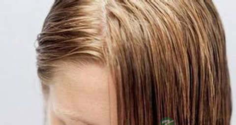 头发油腻脱发怎么办