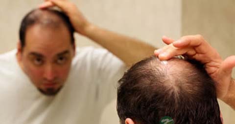 防脱发生发产品