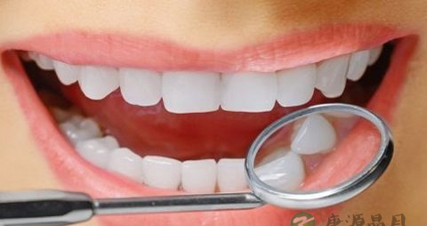 洗牙结石多少钱