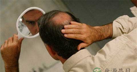 肾虚脱发吃些什么