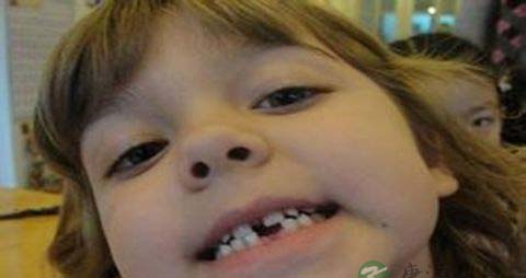 牙齿掉了吃什么