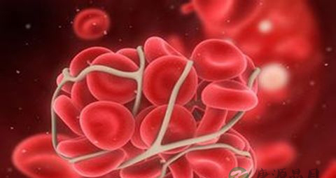 治疗血栓吃什么药