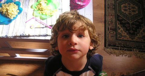 小孩总掉头发是什么原因