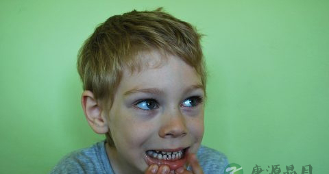 打嗝泛酸怎么办