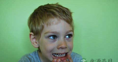 柠檬美白牙齿吗