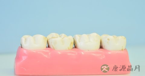 种植牙齿的利与弊