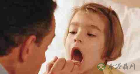 喉咙发炎能不能吃鱼