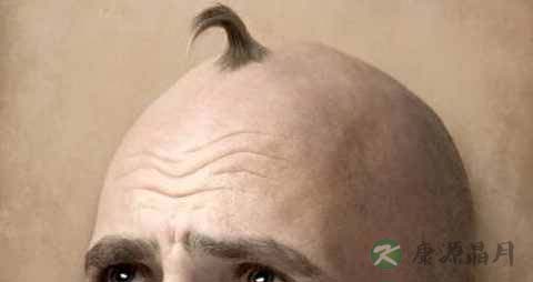 脱发是阴虚还是阳虚