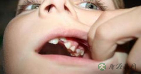 牙齿松动吃什么