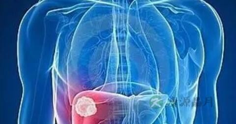 急性甲肝症状有哪些