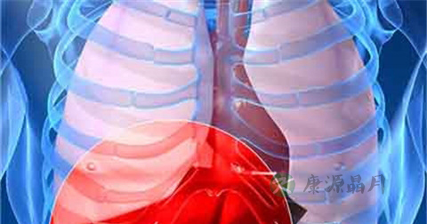 肝脏多发结节怎么办