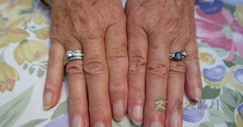 扳手指会变粗吗